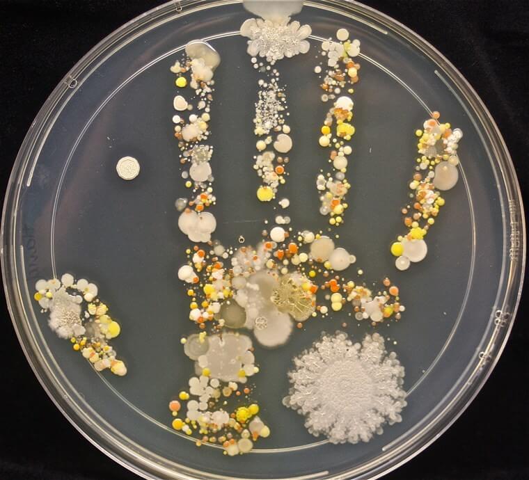 cultures in a petri dish in the shape of a child's hand